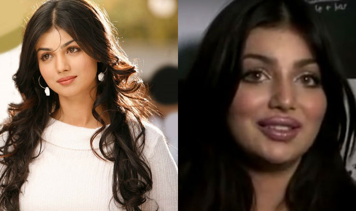 From Ayesha Takia To Anushka Sharma: 10 Bollywood Celebrities With Worst Plastic Surgeries