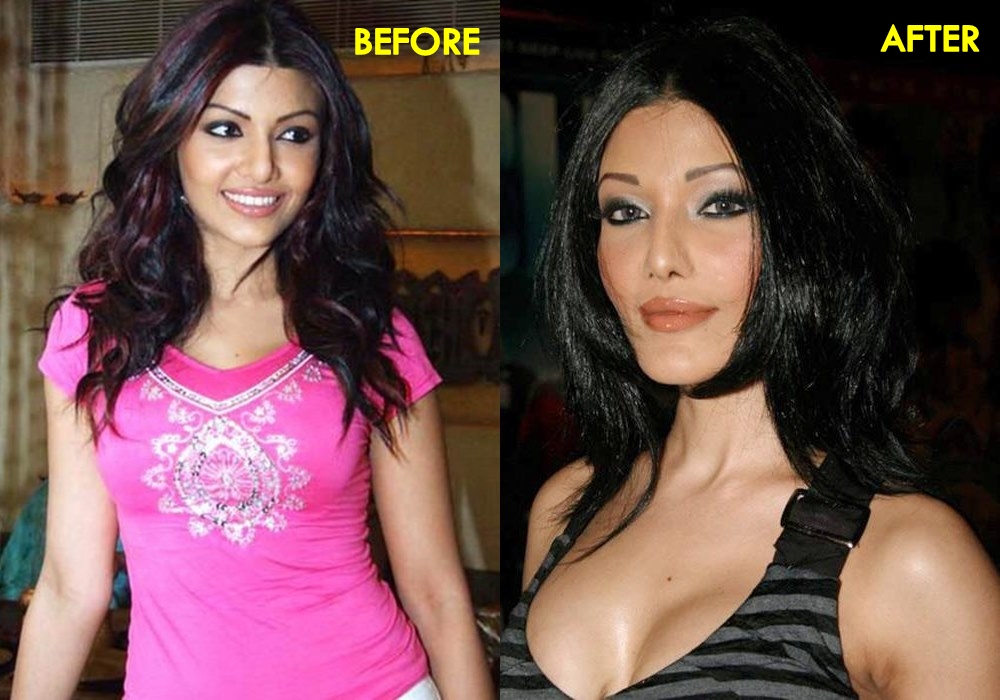 Koena Mitra- Before & After