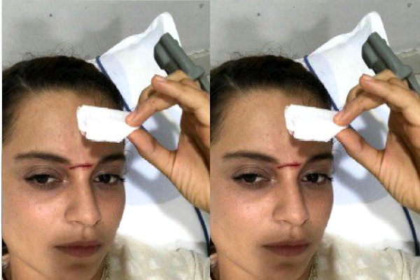 Kangana Ranaut gets hit by a sword on her forehead